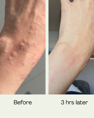 Snail Serum - 2025 Reformulation