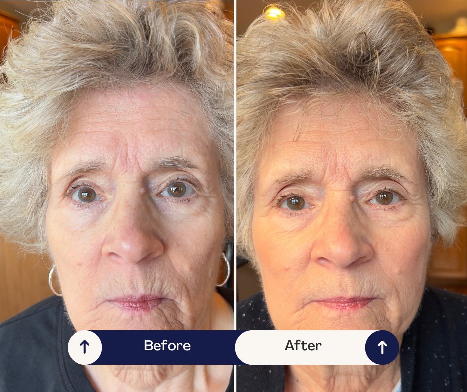 Sara's Skin Transformation Routine